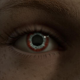 Eye fdsgsdgs